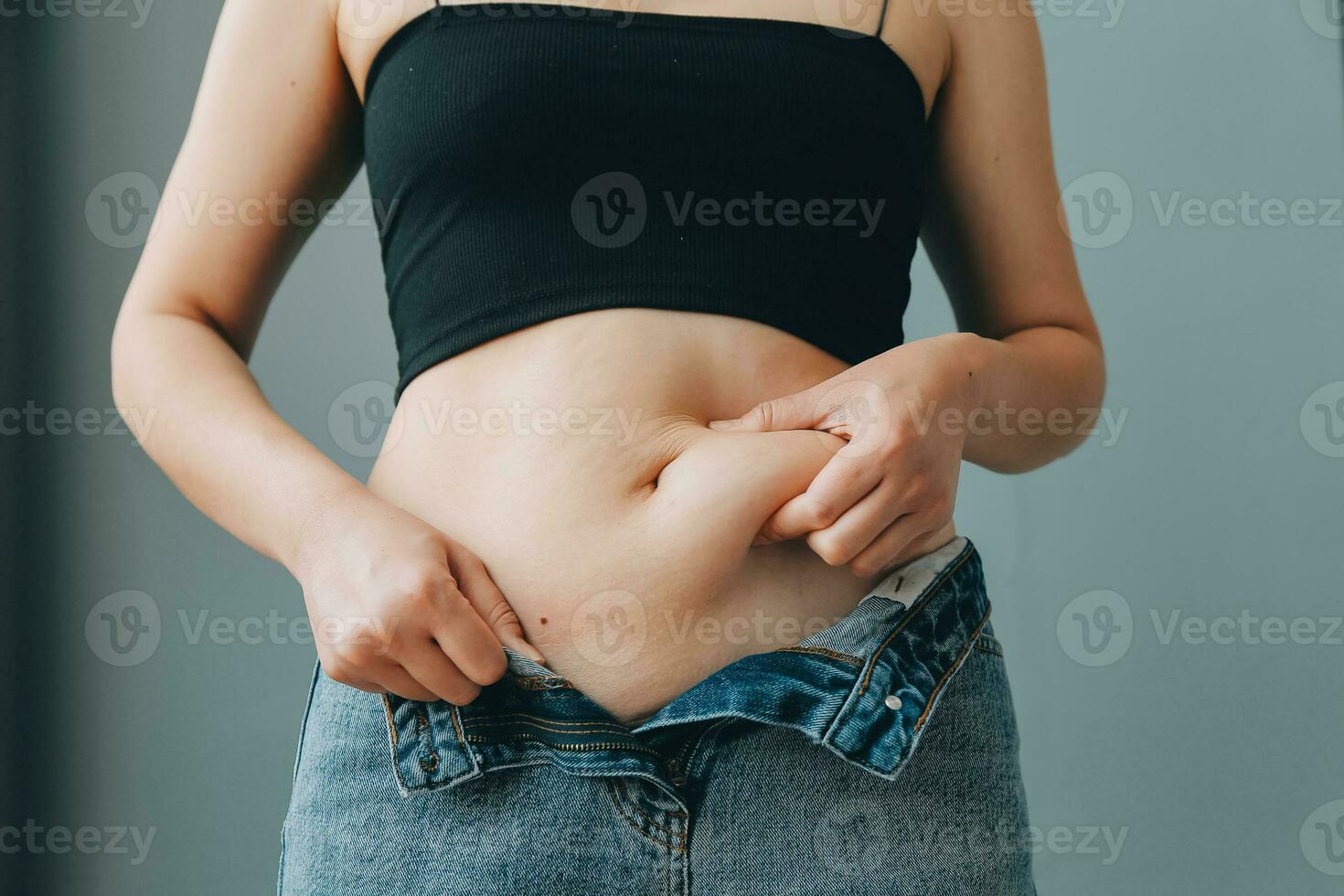 vicino su di un' pancia con cicatrice a partire dal cesareo e addominale Grasso. Da donna Salute. un' donna vestito su nel abbigliamento sportivo dimostrando sua imperfetto corpo dopo un' parto con asilo su il sfondo. foto