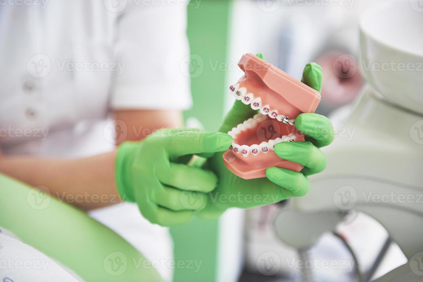 il dentista mostra come l'apparecchio corregge i denti usando un modello di mascella artificiale foto
