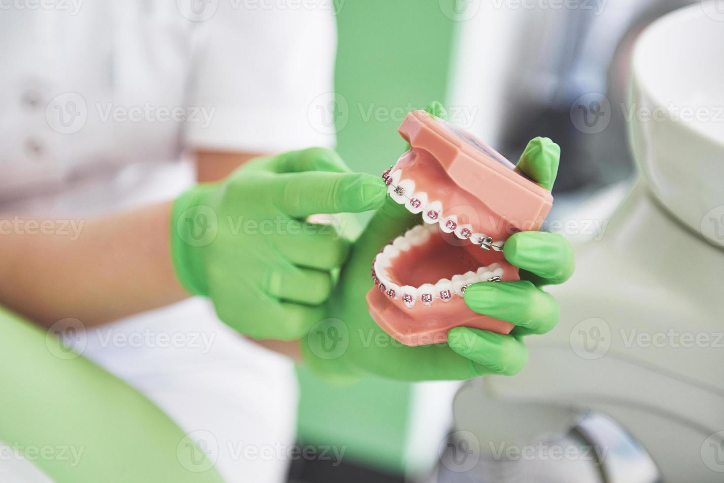 il dentista mostra come l'apparecchio corregge i denti usando un modello di mascella artificiale foto