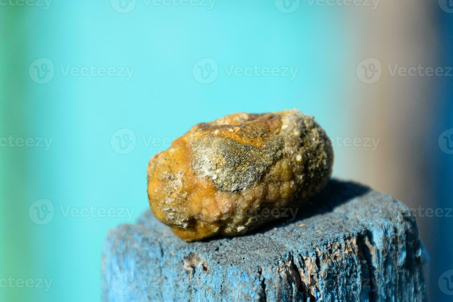 fiele Vescica urinaria pietra. calcolo di eterogeneo composizione foto