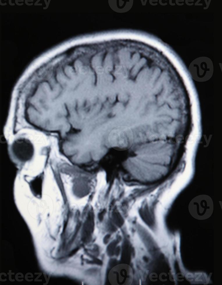 una vera risonanza magnetica del sistema vascolare cerebrale foto