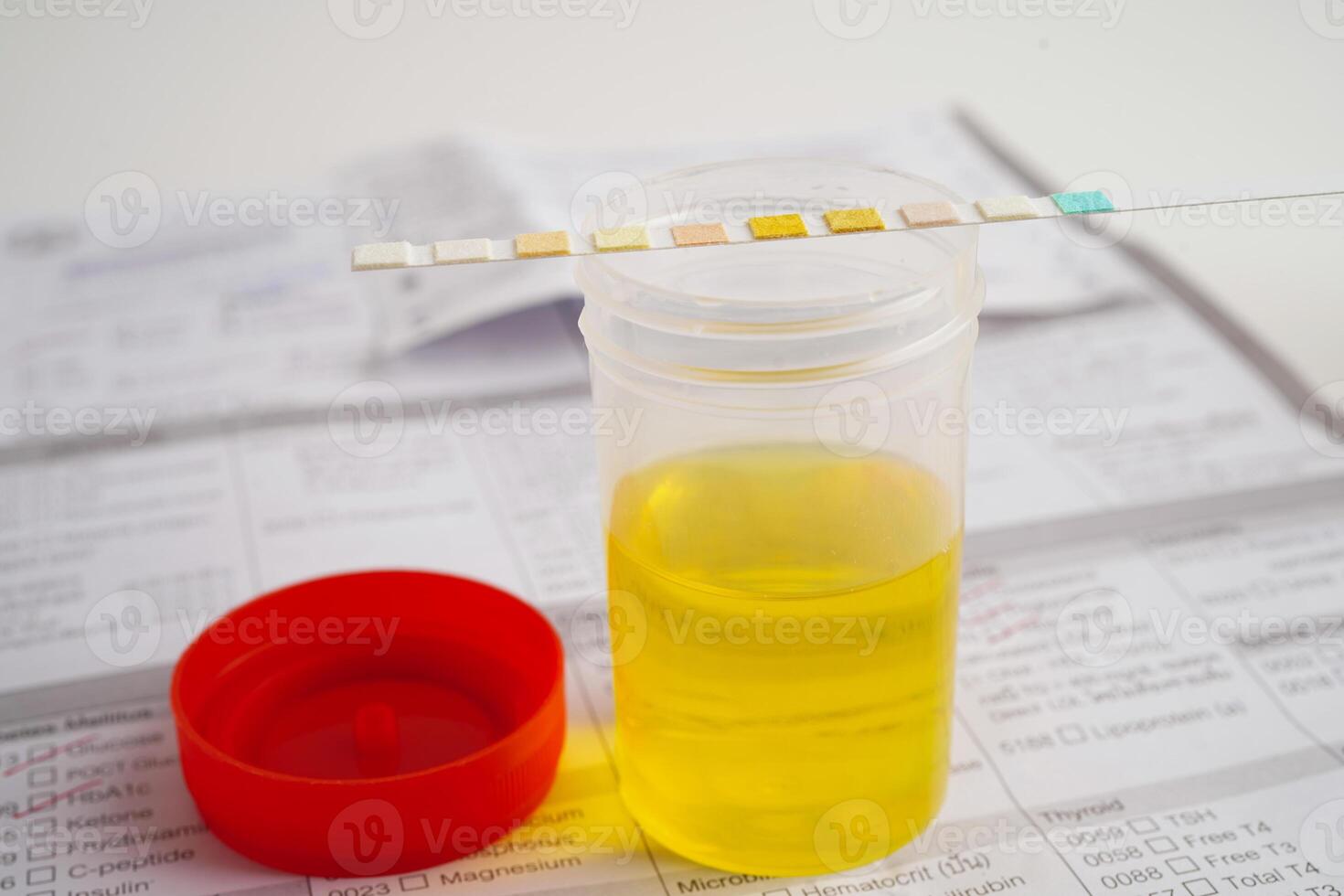 analisi delle urine, urina tazza con reagente striscia ph carta test e confronto grafico nel laboratorio. foto