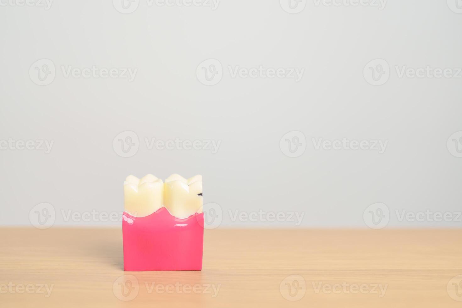 dente anatomia modello. orale denti decadimento e patologia, raschiare via tartaro. marzo orale Salute, dentista giorno, falso denti. mal di denti e bambini dentale Salute mese e ortodontico Salute giorno foto