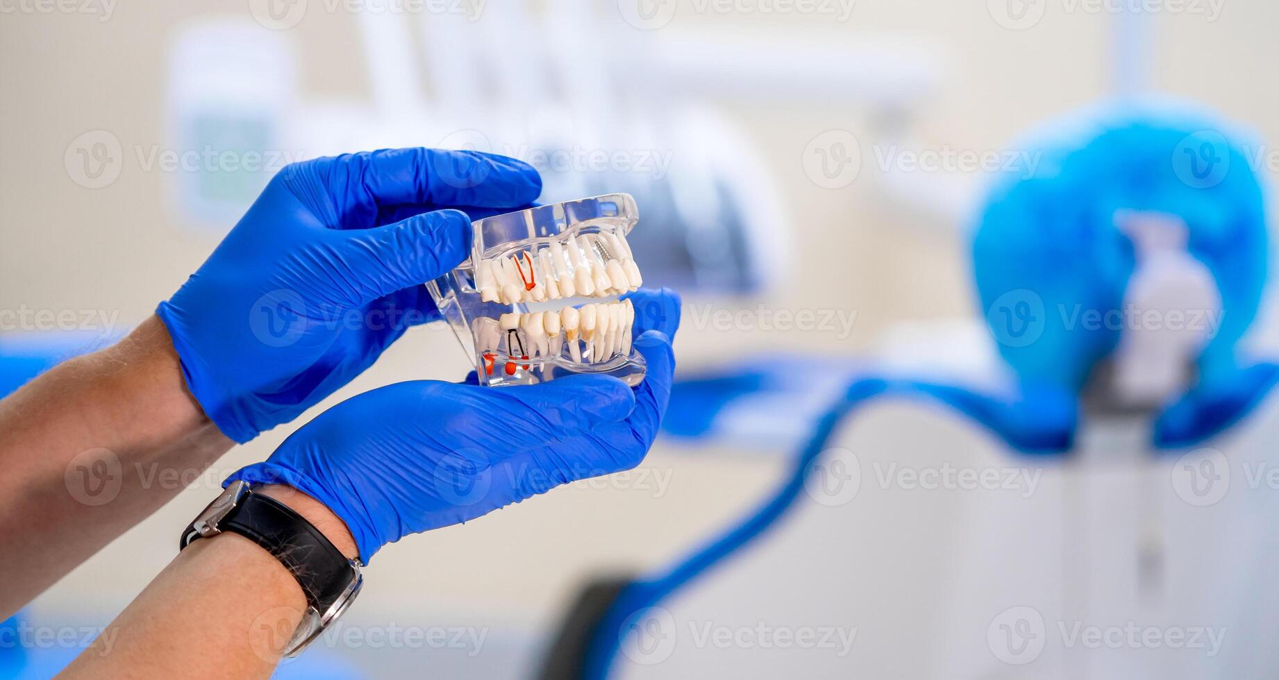 plastica mascella nel il dal dentista ufficio. il medico detiene dentale impianti nel mani. blu guanti. selettivo messa a fuoco. avvicinamento. foto