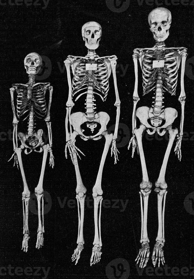 diverso dimensioni di il umano scheletro, Vintage ▾ incisione. foto
