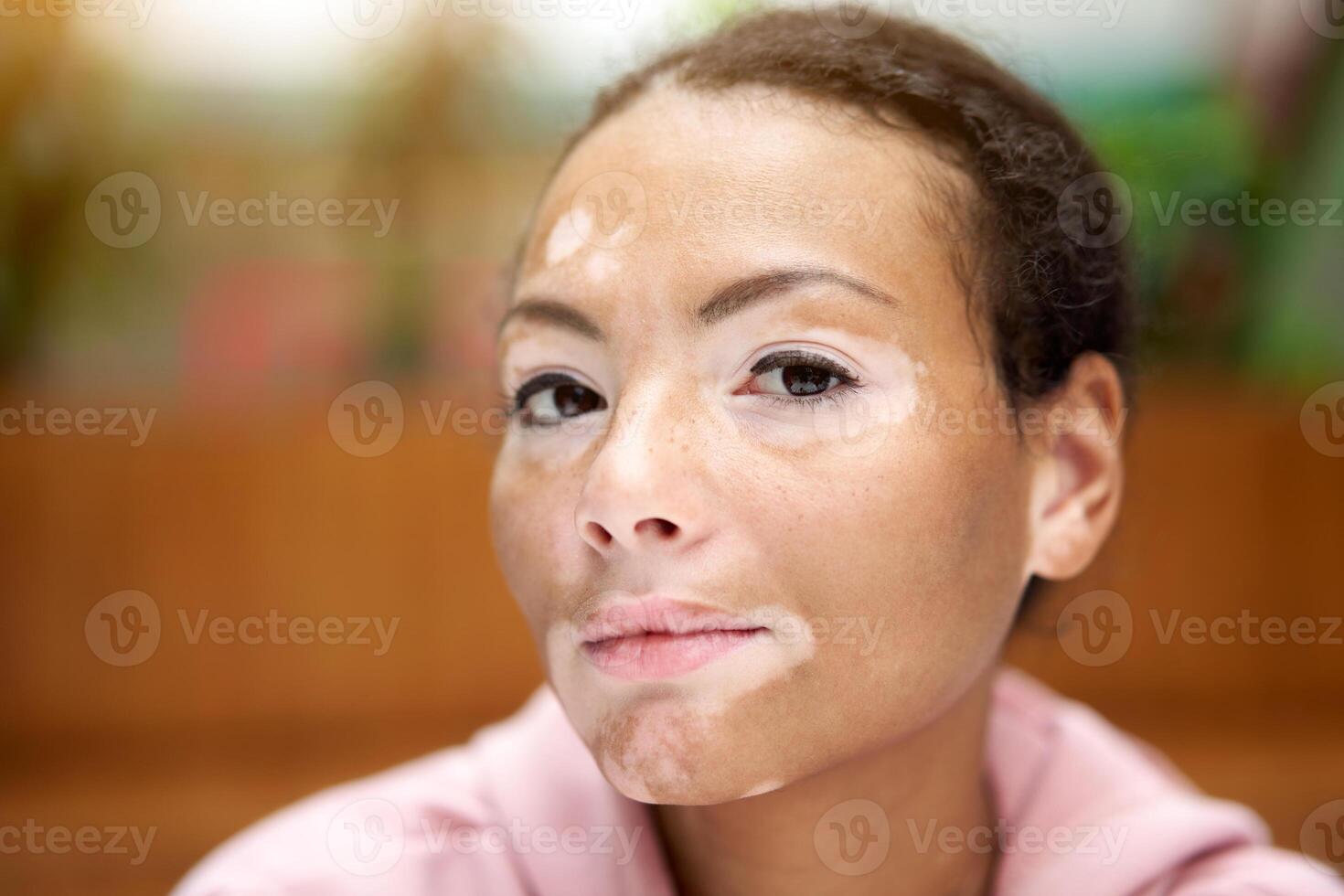 nero africano americano donna con vitiligine pigmentazione pelle problema interno vestito rosa felpa con cappuccio foto