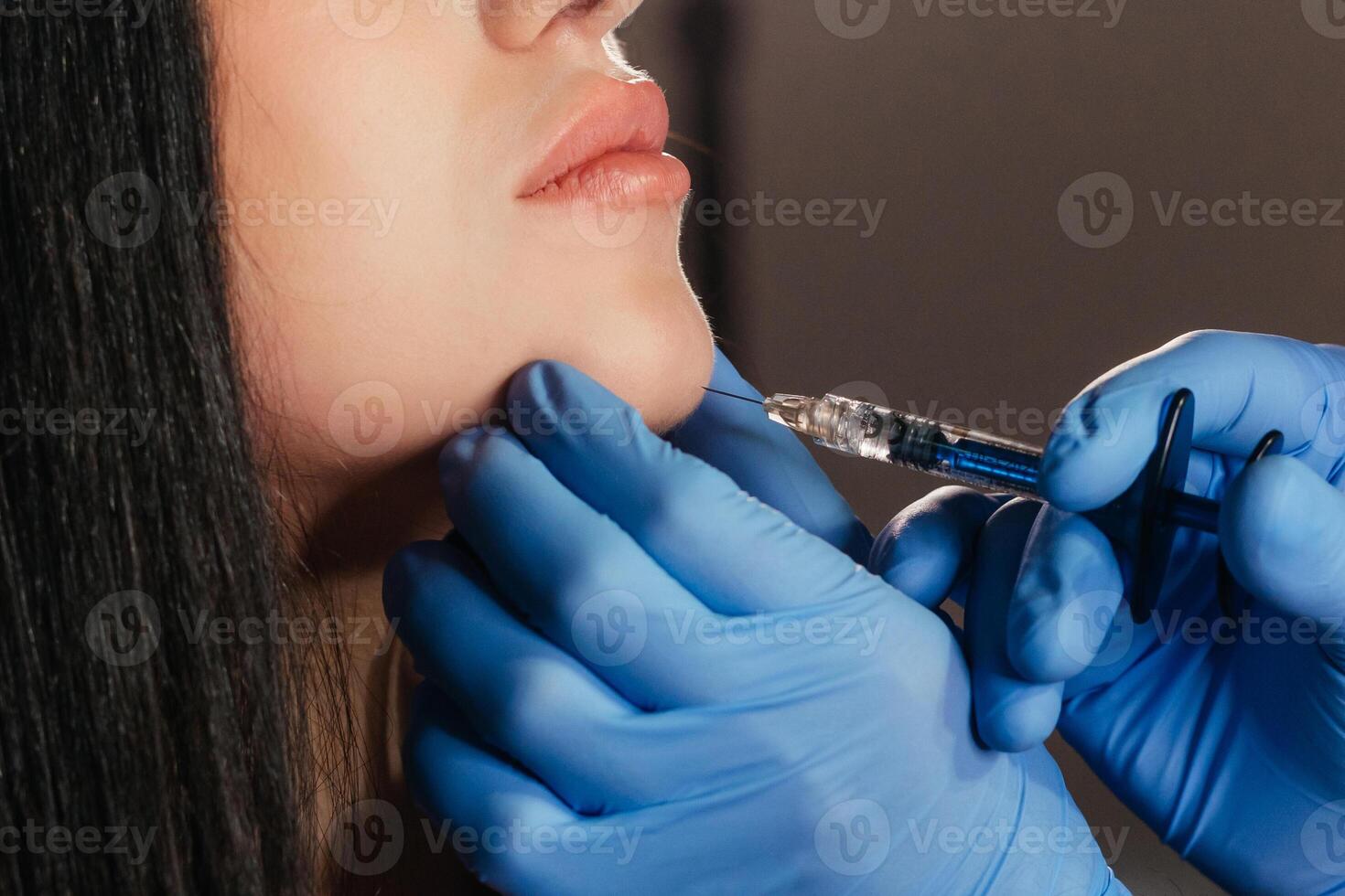 avvicinamento di giovane donna ricevente iniezione nel bellezza salone. cosmetologia. riempitivo iniezione mento rendere mento più a lungo foto