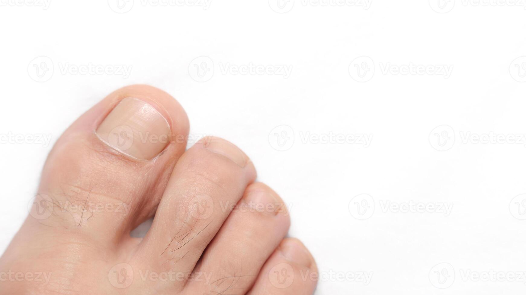 avvicinamento di un' dito del piede con bianca sfondo e spazio per testo su il giusto foto