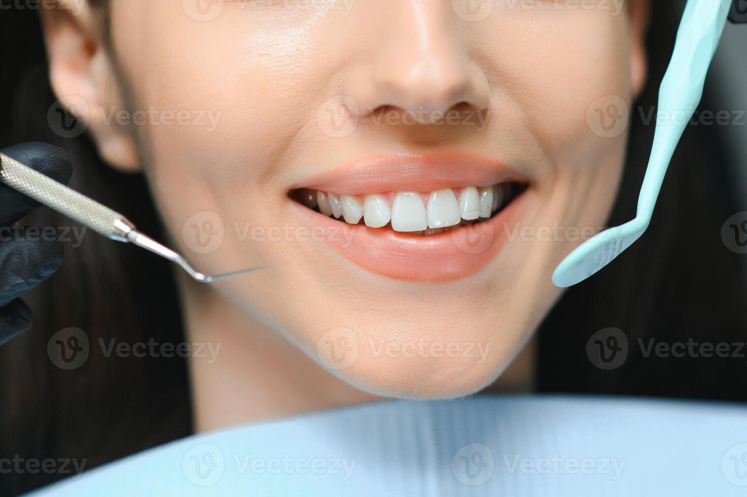 stomatologia concetto, parziale ritratto di ragazza con forte bianca denti. avvicinamento di giovane donna a dal dentista, studio, in casa foto