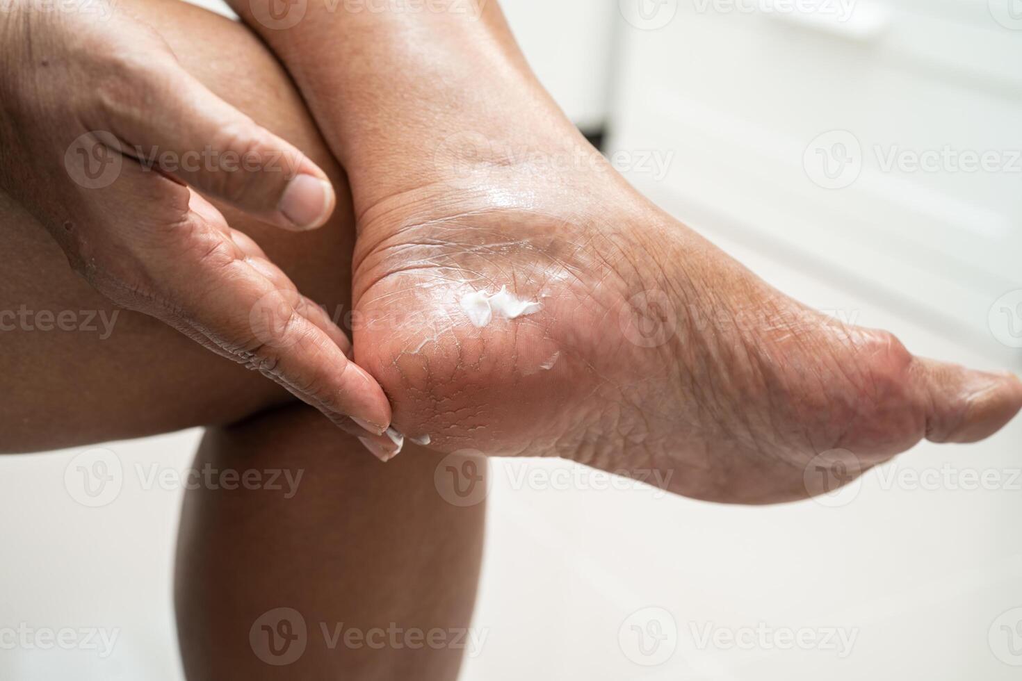 asiatico donna cura piedi con Cracked e asciutto tacco pelle crema a casa. foto