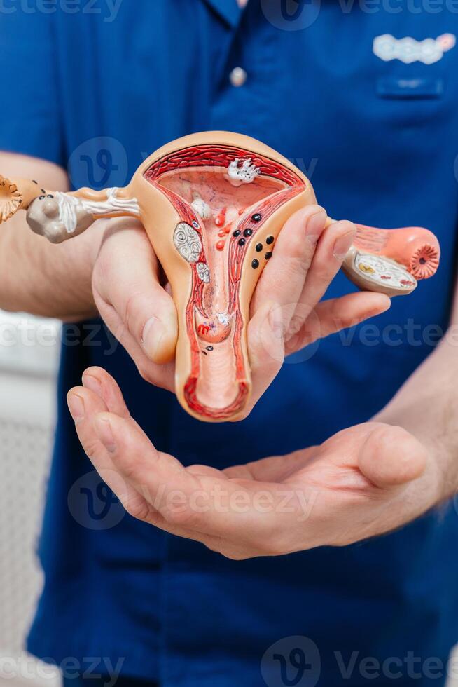 utero, medico Tenere anatomia modello per studia diagnosi e trattamento nel Ospedale. riproduttore femmina sistema ginecologico malattie concetto foto