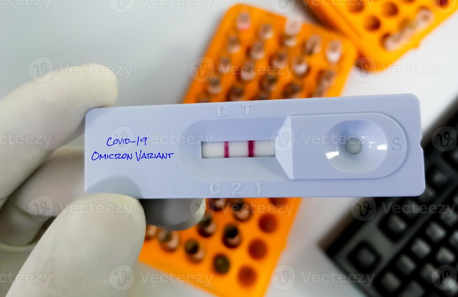 lo scienziato tiene una cassetta di test rapido per la nuova variante del test covid-19 omicron b.1.1.529. una mutazione generica del coronavirus. nuovo ceppo di covid-19, omicron foto