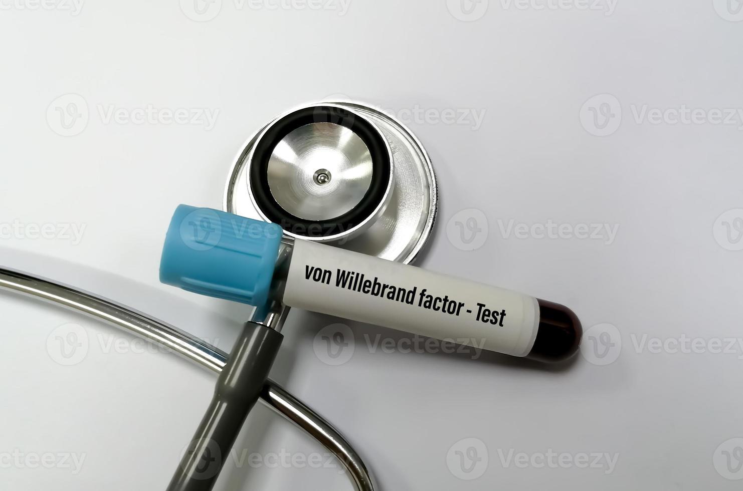 campione di sangue isolato con stetoscopio per test del fattore di von willebrand- vwf. foto