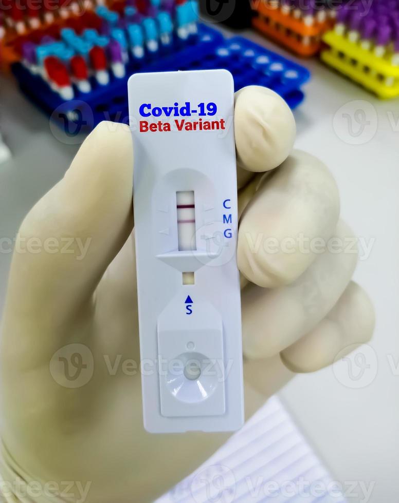 test di screening rapido per la variante covid-19. variante beta foto
