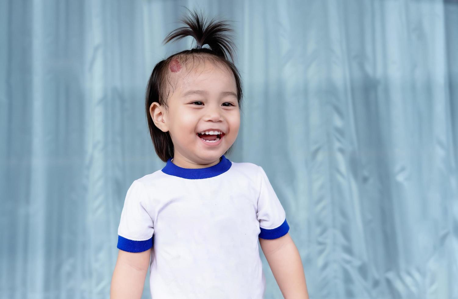 primo piano di un'adorabile bambina con grandi emangiomi capillari alla fragola segno di nascita rosso sulla testa. ragazza sorridente felice, una bambina positiva, guardando la madre o qualcuno. concetto di assistenza sanitaria foto