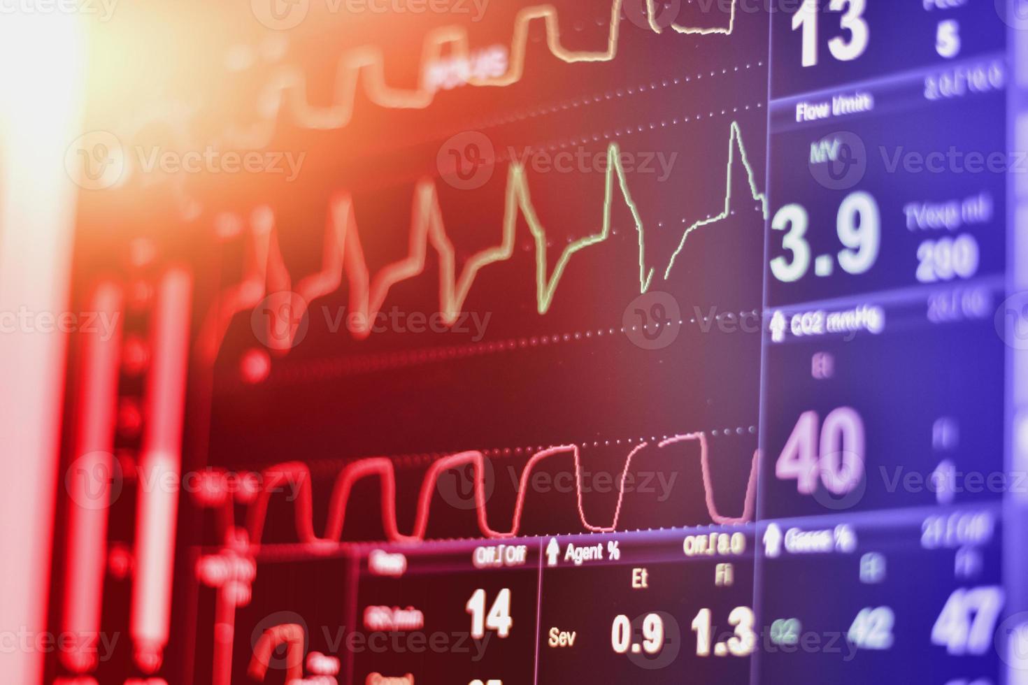 monitor ekg nella pompa a palloncino intra aortico in terapia intensiva su sfondo sfocato, onde cerebrali nell'elettroencefalogramma, onda della frequenza cardiaca foto