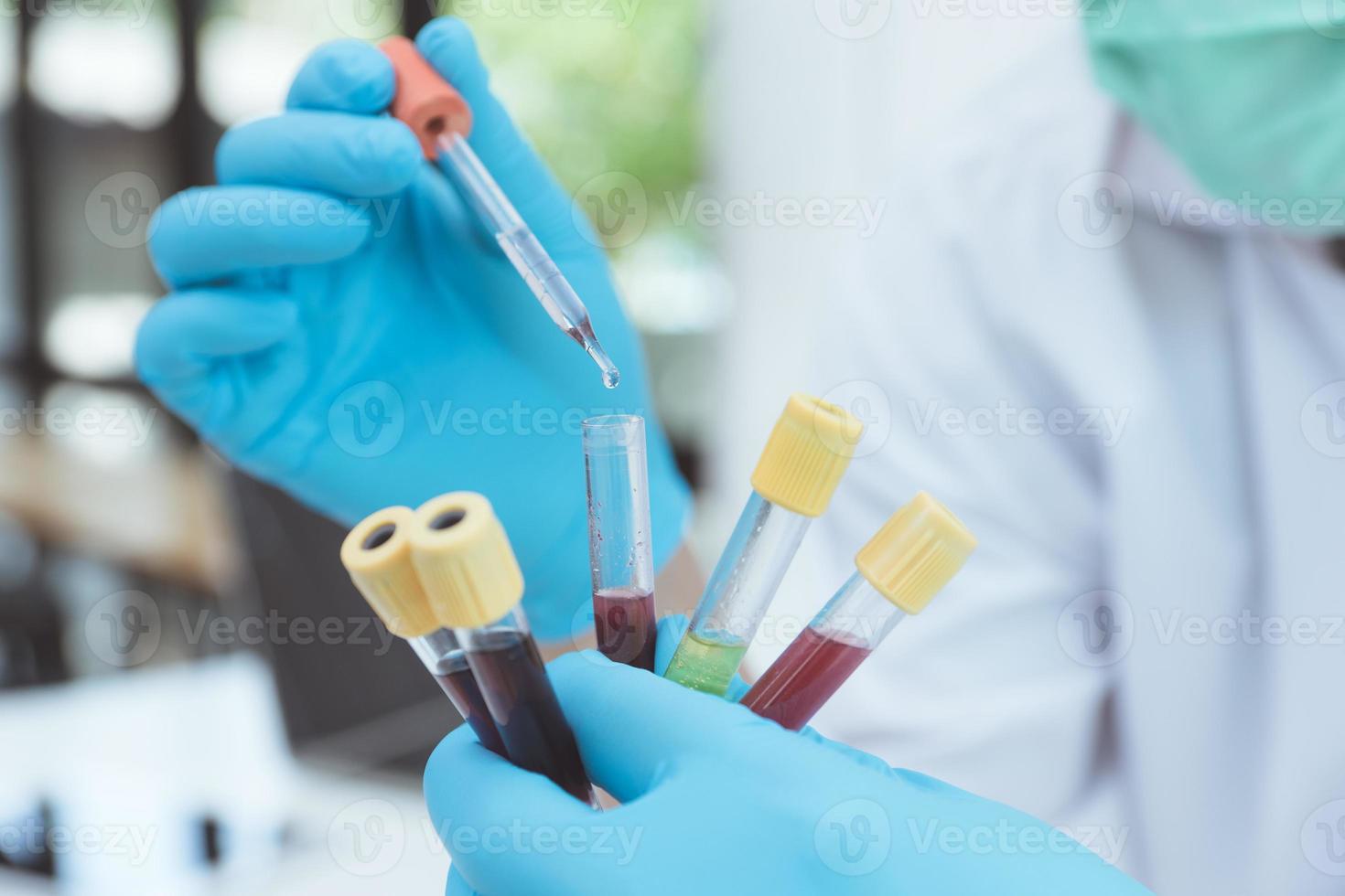 microbiologo o medico scienziato che indossa indumenti di protezione dai rischi biologici con un tubo di campione biologico campione di sangue infetto da coronavirus covid 19 contaminato. foto