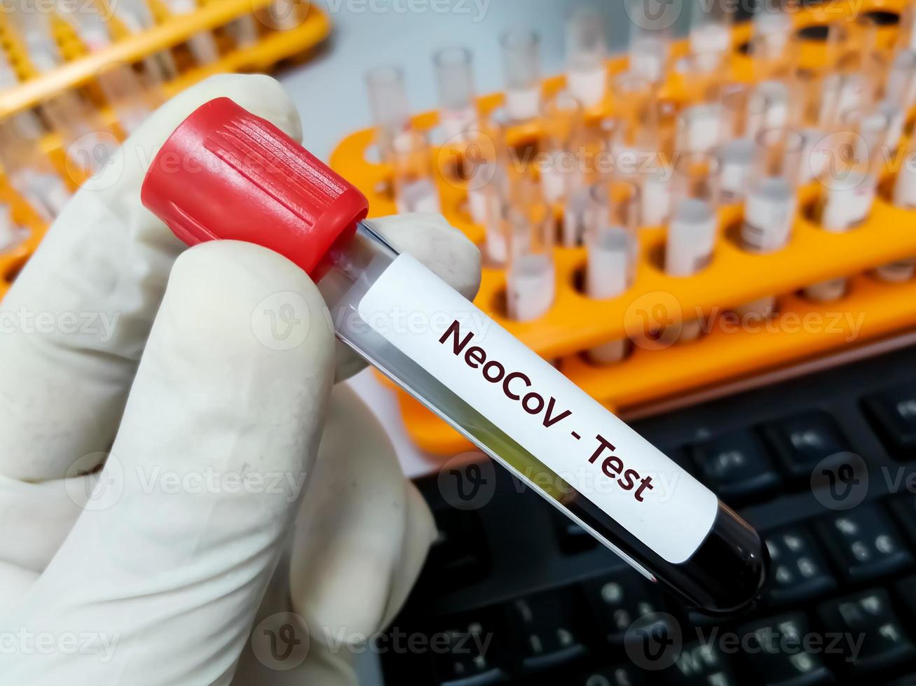 provetta per prelievo di sangue per sars-cov-2, covid-19 nuova variante del test neocov. Gli scienziati di Wuhan avvertono di un nuovo tipo di coronavirus con un alto tasso di mortalità e infezione foto