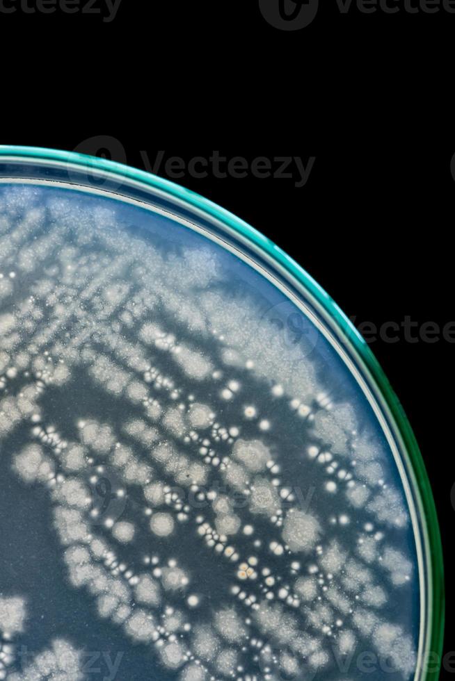 macro di batteri sulla capsula di Petri su sfondo nero foto
