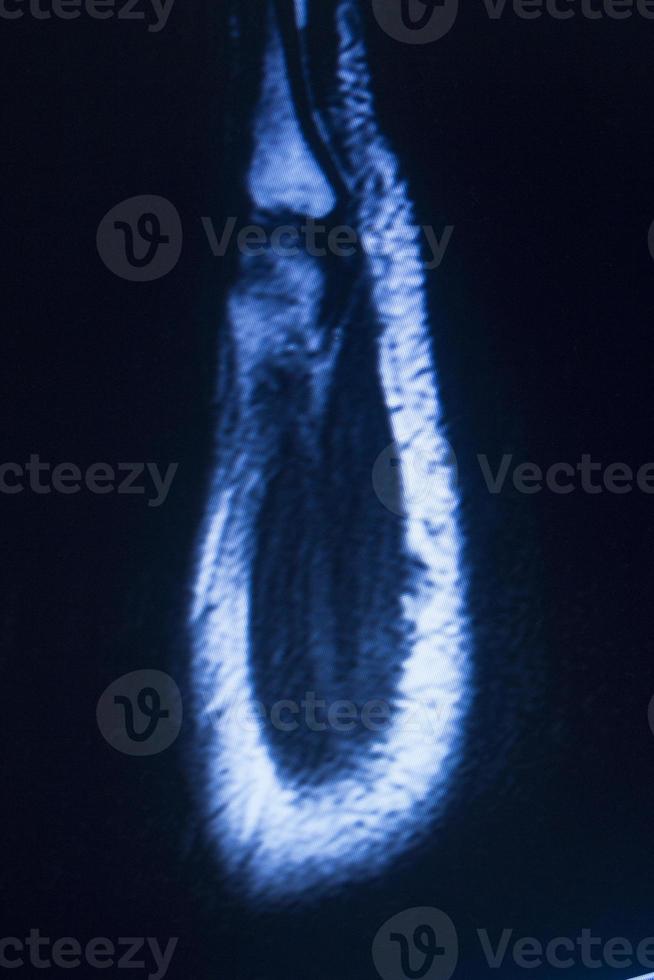 scansione carpale della mano di imaging a risonanza magnetica mri foto