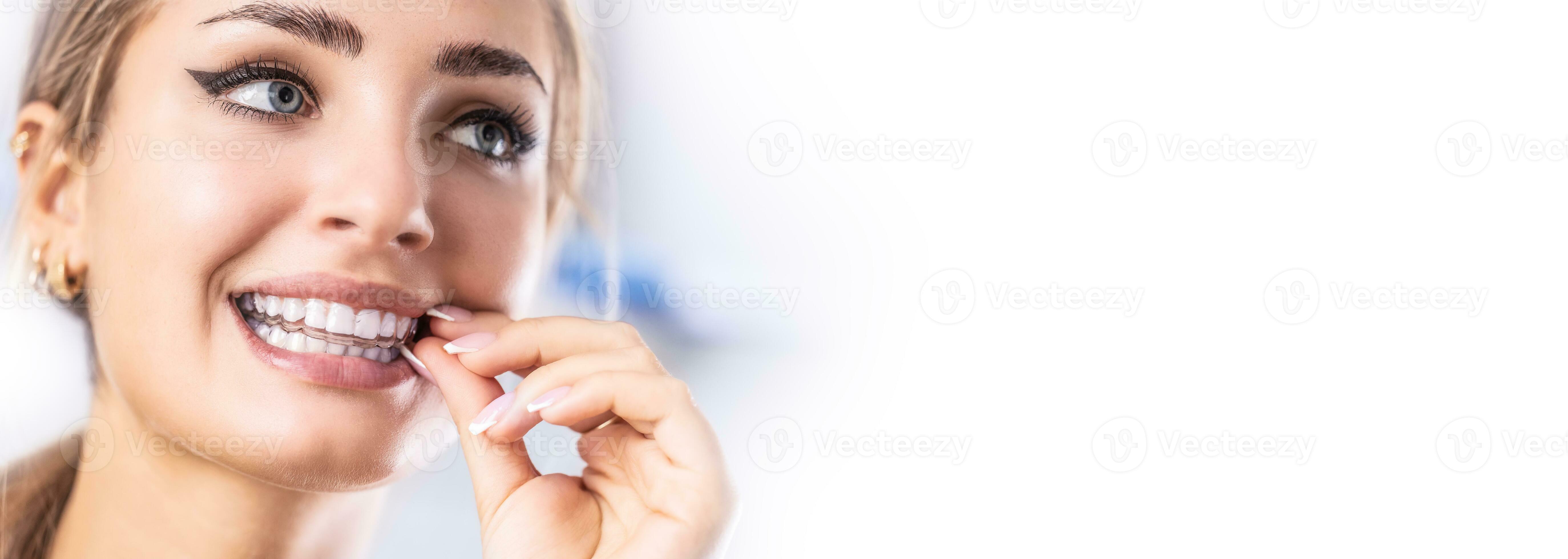 un' donna mette su un invisibile silicone denti allineatore. dentale  bretelle per denti correzione 27583333 Stock Photo su Vecteezy