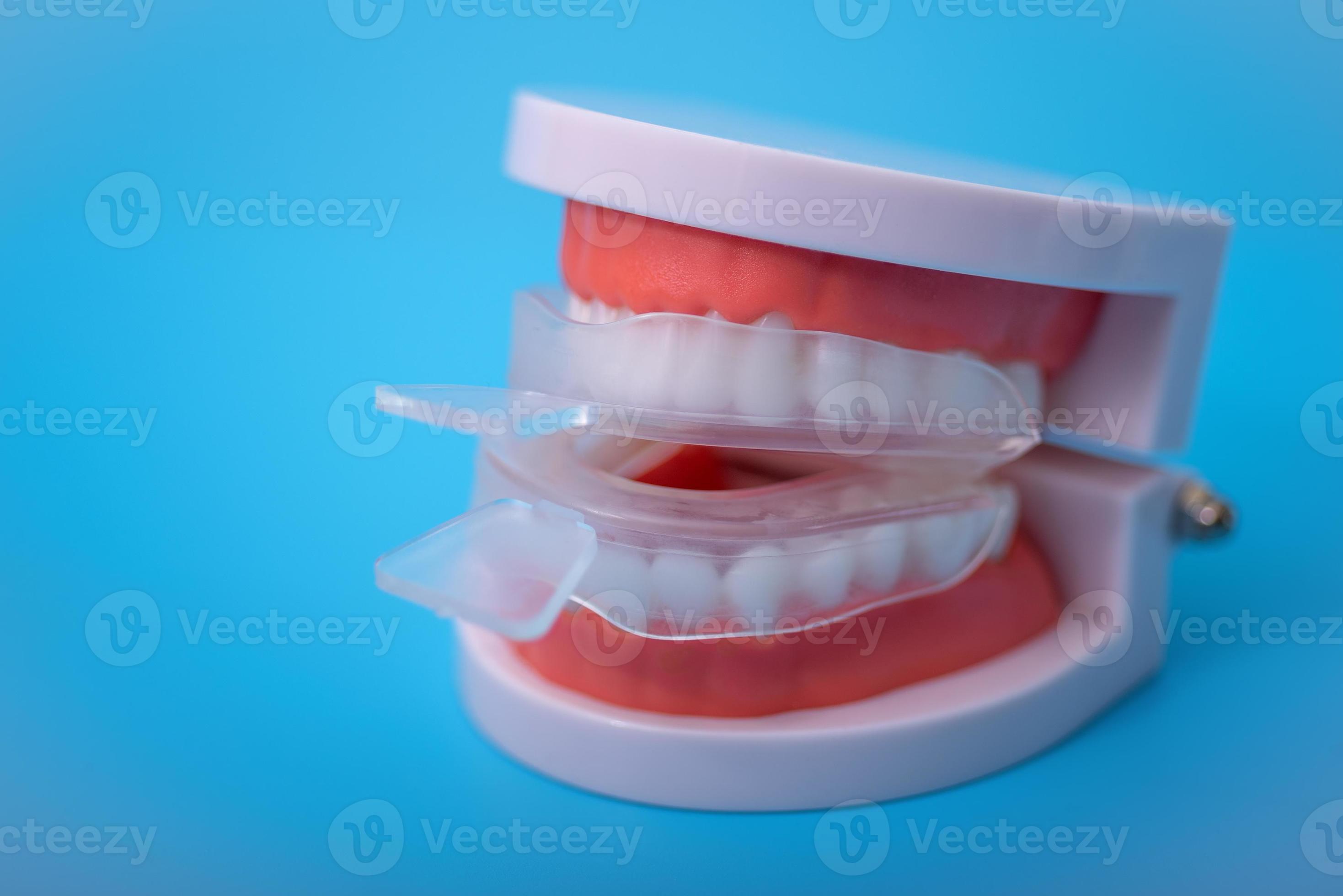 portadenti individuali per sbiancamento e muffe. imitazione di una dentiera  5326690 Stock Photo su Vecteezy