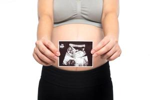 primo piano di una donna incinta che tiene un'immagine ad ultrasuoni su sfondo bianco foto