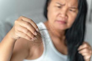 donna asiatica con problema di caduta dei capelli. concetti di cura e bellezza dei capelli. foto