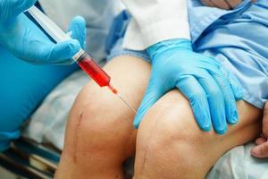 medico asiatico inietta plasma ricco di piastrine di acido ialuronico nel ginocchio della donna anziana per camminare senza dolore. foto