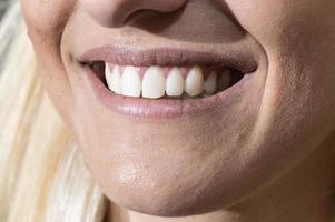 bocca sorridente di ragazza con denti bianchissimi foto