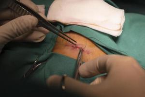 medico che sutura la ferita foto