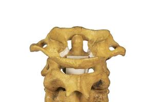 modello di colonna vertebrale cervicale umana artificiale foto