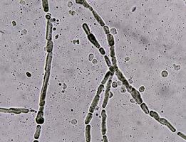 microscopico Immagine mostrando ife di dermatofiti,, pelle raschiatura per fungo test foto