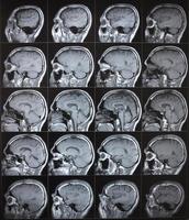 lato Visualizza di umano normale cervello mri foto