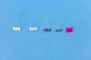 diverso tipi di dentale dente corone foto