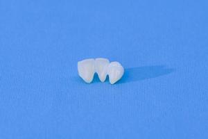 metallo gratuito ceramica dentale corone foto