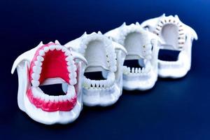dentista ortodontico denti Modelli foto