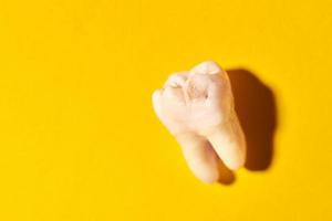 dente del giudizio con carie, sfondo giallo foto