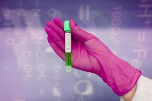 un' guanti di gomma mano detiene uno test tubo con coronavirus foto