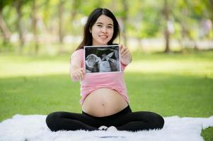un asiatico donna chi è incinta per il primo tempo si siede e rilassa per mostrare sua immagini a partire dal un' ospedale ultrasuono per dai un'occhiata il Salute di sua in crescita bambino foto