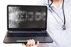 infermiera detiene computer il computer portatile con spinale colonna foto