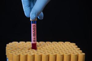 Salute professionale Tenere sangue campione tubo foto