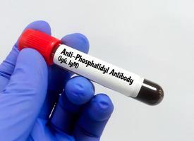 sangue campione per anti fosfatidil anticorpo test. foto