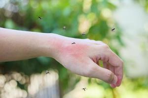 zanzare mordere su adulto mano fatto pelle eruzione cutanea e allergia con rosso individuare foto