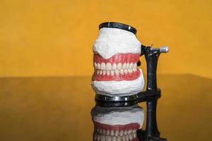 modello di denti per dentisti per spiegare vario dente malattie o i problemi nel giallo sfondo foto