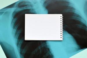raggi X film Immagine di umano il petto per un' medico diagnosi e vuoto vuoto bloc notes pagina su blu ospedale tavolo. piatto posare superiore Visualizza foto