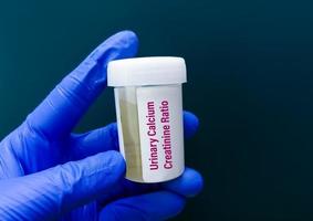 scienziato Tenere campione contenitore con urina campione per urinario calcio creatinina rapporto test. foto