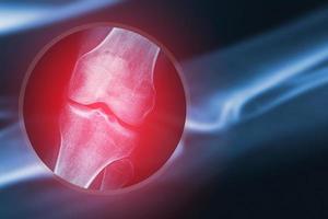 raggi X Immagine di umano ginocchio foto