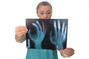 giovane femmina medico guardare a il paziente raggi X foto