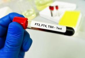 ft3, ft4, tsh test. diagnosi di ipertiroidismo o ipotiroidismo di un' paziente foto